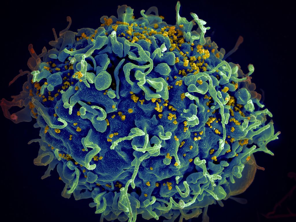 Imagem mostra célula com HIV